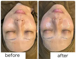 leolo武蔵浦和 肌質改善＆脱毛のエステ・リラクイメージ