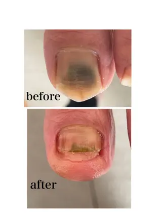 メンズ ネイル Chérinail 爪のお手入れのネイルデザイン