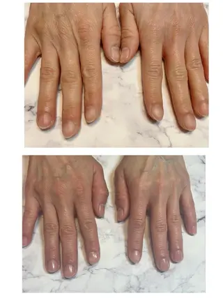 ネイル 高野 祐紀のネイルデザイン