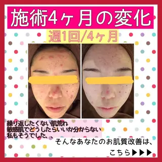 ミディアム カラー パーマ ヘアアレンジ メンズ キッズ ネイル マツエク・マツパ ニキビ・肌質改善専門 ♡人生が変わるサロンのエステ・リラクイメージ