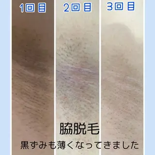 Mia.rosa所属・光フェイシャル・脱毛 MIA.ROSAの眉毛・アイブロウイメージ