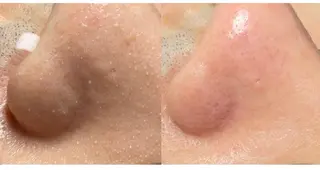 メンズ H&B salon 渋谷店のエステ・リラクイメージ