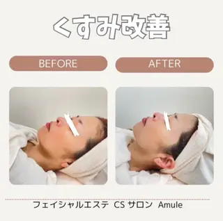 CSサロン Amule所属・🦋肌質改善サロン. anna🦋のエステ・リラクイメージ