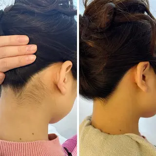 うなじ脱毛/美肌脱毛 LABELのエステ・リラクイメージ