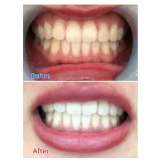 M渋谷店所属・M渋谷 ホワイトニングのエステ・リラクイメージ