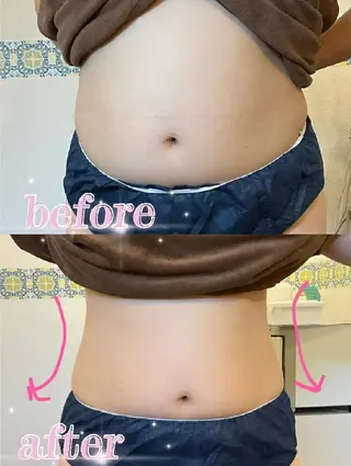 🅖🅤🅩🅔🅛 salonのエステ・リラクイメージ