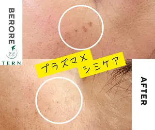 小顔・ニキビ・肌管理 TERN 南草津店のエステ・リラクイメージ