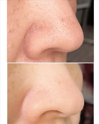 hari salon de off　美容鍼灸×小顔整体【ハリサロンドオフ】所属・美容鍼灸×小顔整体♡ ハリサロンドオフ堺東のエステ・リラクイメージ