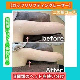 痩身/脱毛/ネイル HARUKAのエステ・リラクイメージ