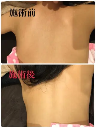 キッズ 【リベルハーブピーリング認定店】敏感肌・美白脱毛専門店Dione立川店所属・Dione 立川店のエステ・リラクイメージ