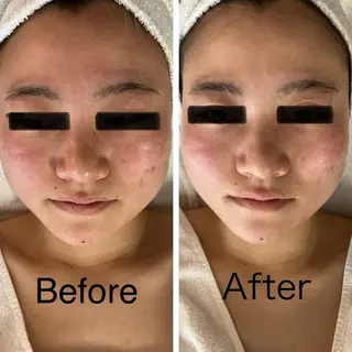 エステサロン Minkのエステ・リラクイメージ