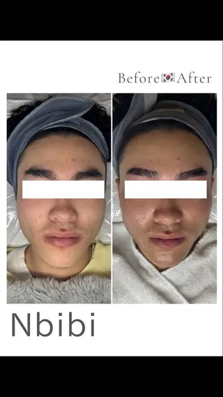 韓国🇰🇷価格 サロン_Nbibiのエステ・リラクイメージ