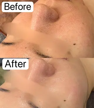 Belle原宿所属・佐藤 加奈のエステ・リラクイメージ