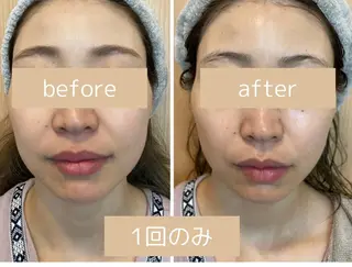 腸もみ・痩身エステ 🌼YURIのエステ・リラクイメージ