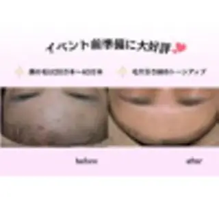 🌿小顔・痩身・脱毛 レイビス川崎店🌿のエステ・リラクイメージ