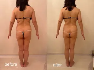 小顔×痩身専門サロンCLORE浦和店所属・石川 彩花のエステ・リラクイメージ