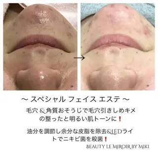 ビューティー ミロワールのエステ・リラクイメージ