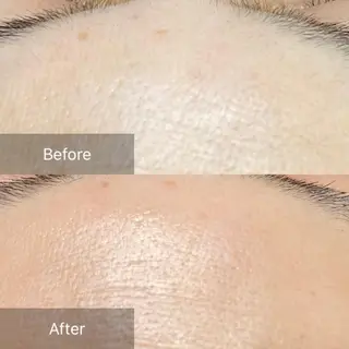 産毛専門店 Bittoのエステ・リラクイメージ