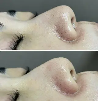 ecrin (エクラン)のネイルデザイン