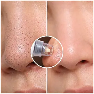 MORE BEAUTY ESTHE 本通り店所属・more ‎‪𓍯 ‬のエステ・リラクイメージ