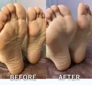 hitohana所属・毛穴/いちご鼻/小顔 /hitohanaのエステ・リラクイメージ