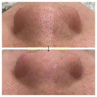 ビューティー ミロワールのエステ・リラクイメージ