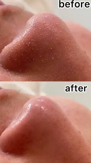 シミケア肌改善専門 トリニエンス新宿店のエステ・リラクイメージ