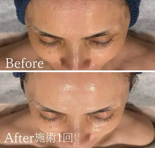 アンド ミルルのエステ・リラクイメージ