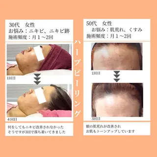 小顔・ツルツル素肌 ハリステリアのエステ・リラクイメージ