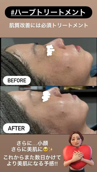 LiZA エステティックサロンのエステ・リラクイメージ