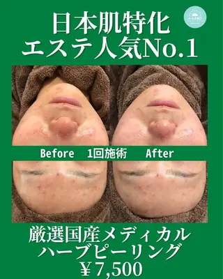 e-LABO 池袋のエステ・リラクイメージ