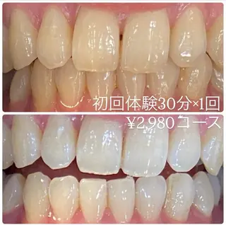 メンズ ホワイトニングルーム　川崎店所属・ホワイトニング ルーム　川崎店のその他イメージ