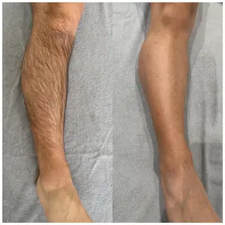 メンズ REAL beauty salon所属・【脱毛専門】 REALbeautyのエステ・リラクイメージ