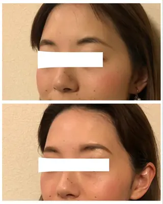 アイブロウ Leading Ladiesのエステ・リラクイメージ