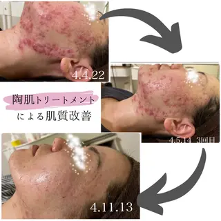 aimee　肌質改善サロン【アイミー】所属・肌質改善サロン aimee｜アイミーのエステ・リラクイメージ