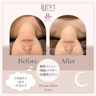 Luno所属・Luno REVI導入サロンのエステ・リラクイメージ