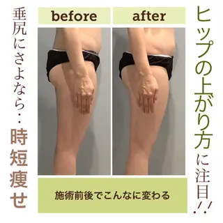 エステサロン JURISのエステ・リラクイメージ