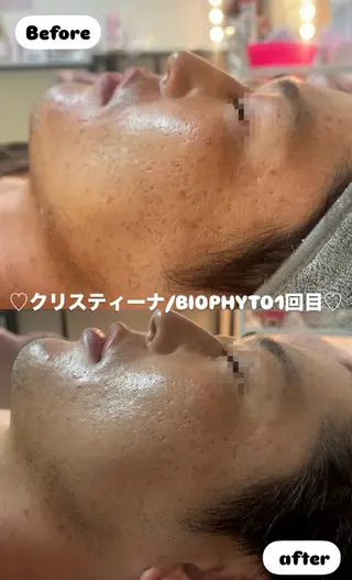 ビューティーサロン レビュールのエステ・リラクイメージ