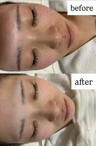 OTOHA / ありむらのエステ・リラクイメージ