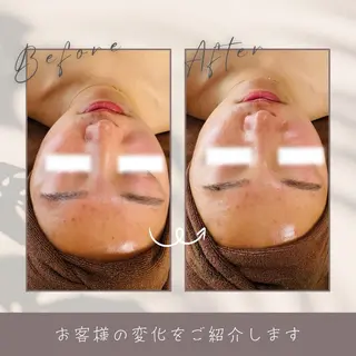 LukeBeauty salonのエステ・リラクイメージ