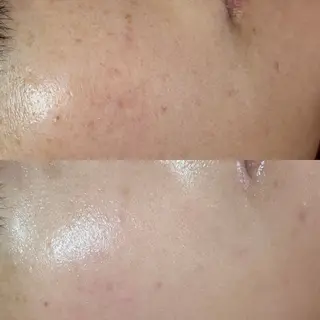 abbellina×UNO出雲塩冶店《ウノ》所属・フェイシャルエステ 🫧琉衣のエステ・リラクイメージ