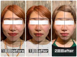 💎後悔させない小顔 矯正💎イトヤマ🌱のエステ・リラクイメージ