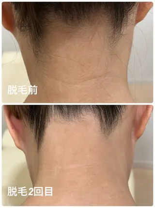 脱毛サロン　　　ベル・マタン所属・脱毛サロン ベル・マタンのエステ・リラクイメージ