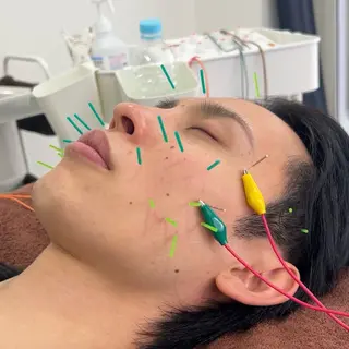 美容鍼×小顔×姿勢× ブライダル整体のエステ・リラクイメージ