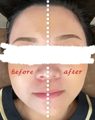 Folche三川町ア ピールポイント確認！のエステ・リラクイメージ