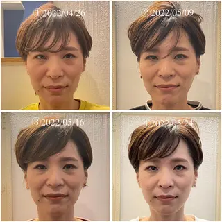 美容鍼　蒼月-aotsuki-所属・美容鍼「蒼月」 -アオツキ-のエステ・リラクイメージ