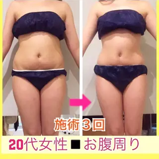 ショート カラー パーマ ヘアアレンジ メンズ キッズ ネイル マツエク・マツパ ‍痩身＆ボディ 結果出し🌟丹野のエステ・リラクイメージ