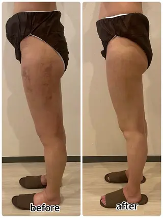 💎インディバ GEM💎indiba   healing room GEM所属・💎 GEM💎のエステ・リラクイメージ