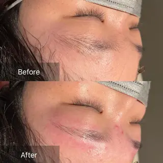 アイブロウ for woman所属・森 美優のエステ・リラクイメージ