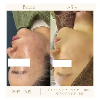 ラヴィエベル 中嶋のエステ・リラクイメージ